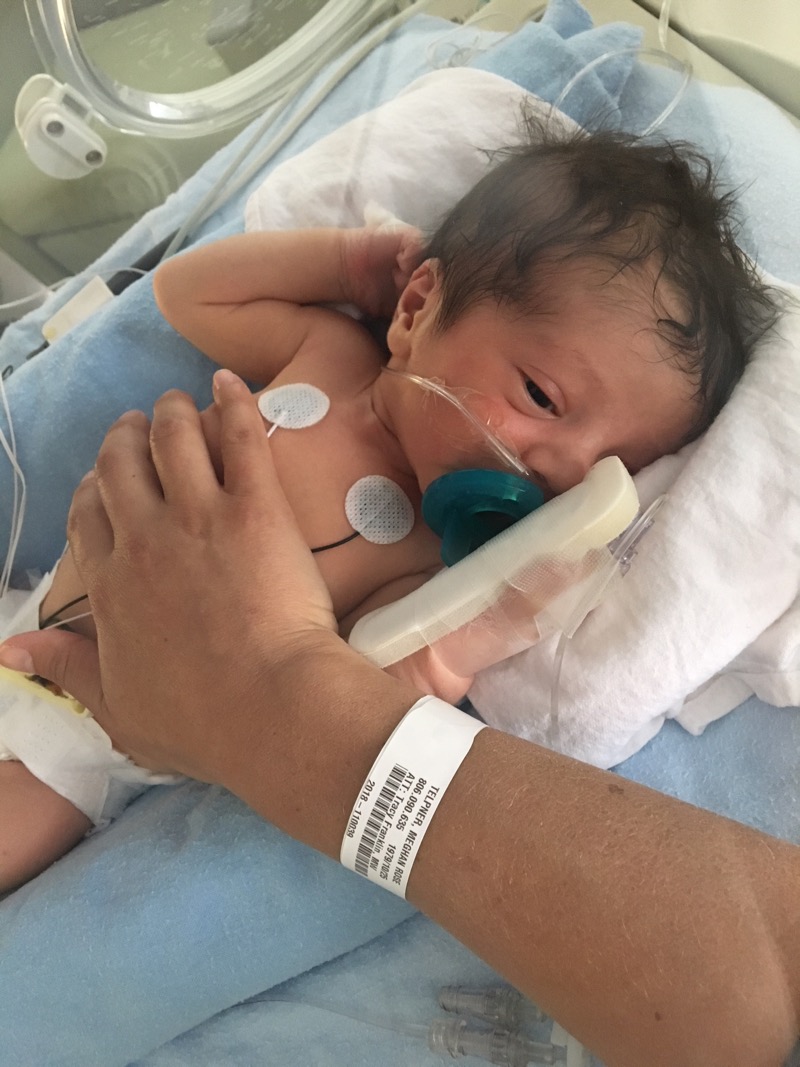 Our Birth Story - NICU 1